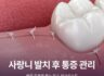 사랑니 발치 후 통증 관리, 빠른 회복을 돕는 필수 체크리스트