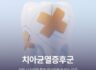치아균열증후군, 저작 시 찌릿한 통증 방치하면 안 되는 이유