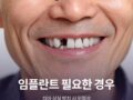 임플란트 필요한 경우와 치아 상실 방치 시 위험성