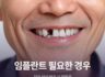 임플란트 필요한 경우와 치아 상실 방치 시 위험성