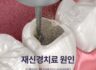 크라운 내부에 또 염증이? 주요 재신경치료 원인과 위험 신호