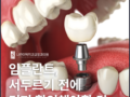 부평시장역 치과 발치 후 임플란트 서두르기 전에 확인하세요
