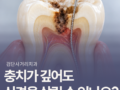 [검단사거리치과] 같은 충치인데 치과마다 신경치료 여부가 달랐다면?